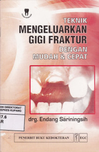 Image of Teknik Mengeluarkan Gigi Fraktur Dengan Mudah & Cepat