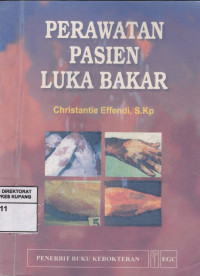 Image of Perawatan Pasien Luka Bakar