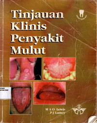 Image of Tinjauan klinis penyakit mulut = Clinical Oral medicine