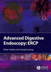 Image of ADVANCED DIGESTIVE ENDOSCOPY: ERCP