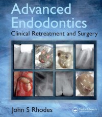 Image of Advanced Endodontics