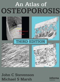 Image of An Atlas of OSTEOPOROSIS