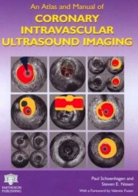 Image of An Atlast and Manual Coronary