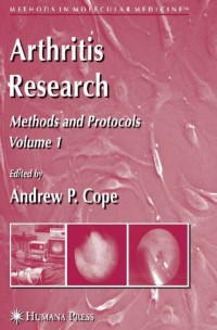 Image of Arthritis Research