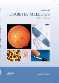Image of Atlas of Diabetes Mellitus