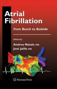 Image of Atrial Fibrillation