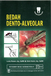 Image of Bedah dento-Alveolar