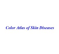Image of Color Atlas of Skin Diseases