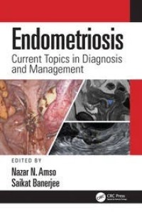 Image of Endometriosis