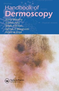 Image of Handbook of Dermoscopy