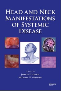 Image of Head and Neck Manifestations of Systemic Disease