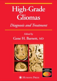 Image of High-Grade Gliomas Diagnosis and Treatment