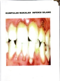 Image of Kumpulan makalah infeksi silang