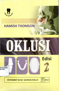 Image of Oklusi