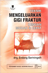 Image of Teknik mengeluarkan gigi fraktur dengan mudah dan cepat