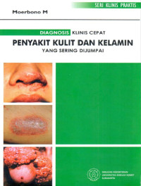 Image of Diagnosis Klinis Cepat Penyakit Kulit Dan Kelamin Yang Sering Dijumpai